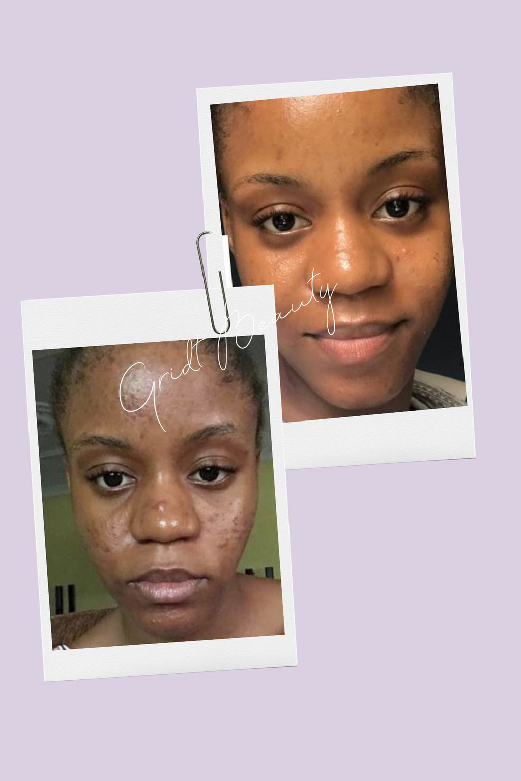 Lumi Bright, Anti-aging Day and Night Full Kit