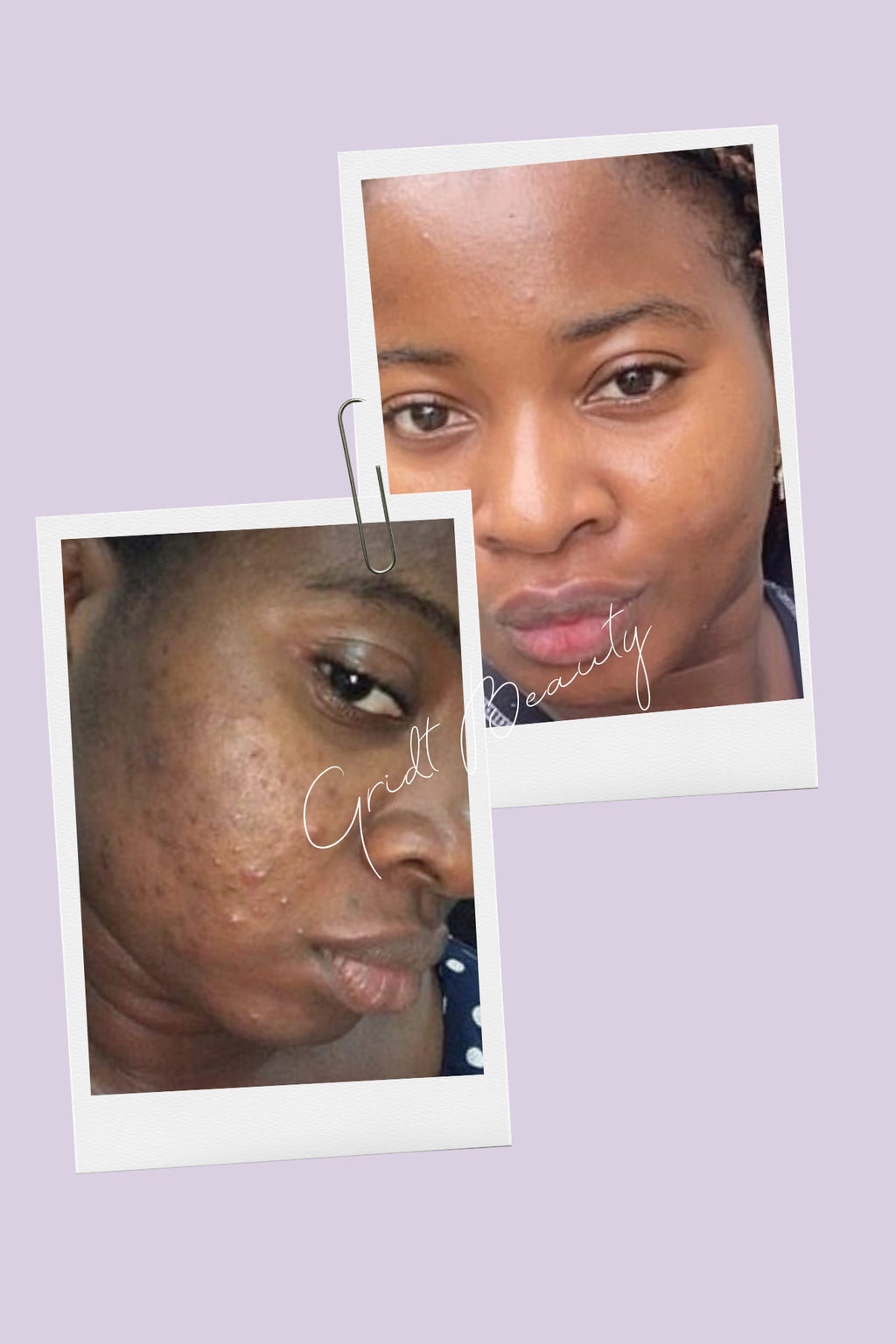 Lumi Bright, Anti-aging Day and Night Full Kit