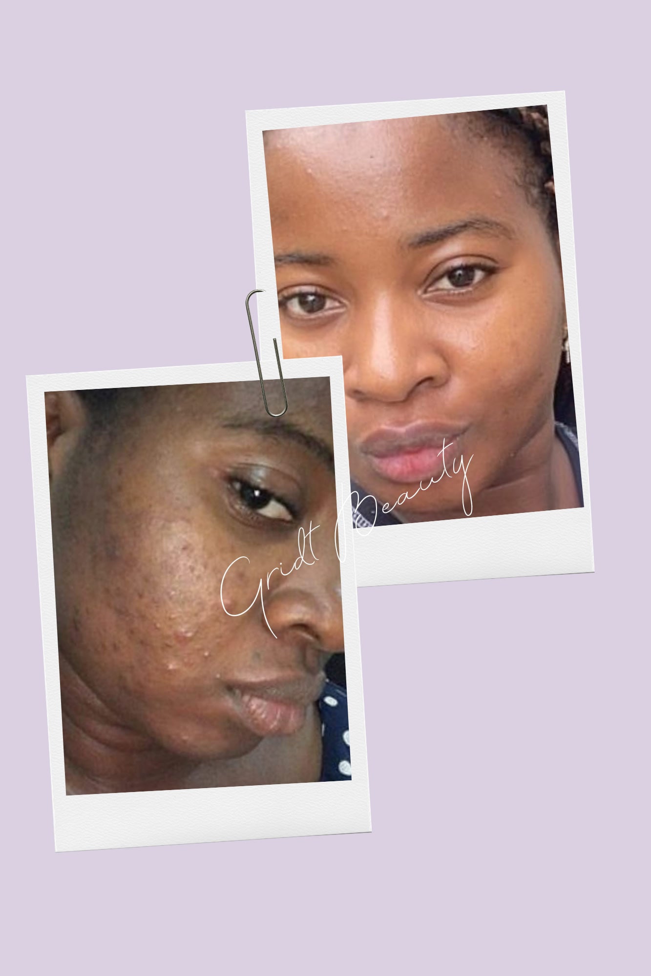 Lumi Bright, Anti-aging Day and Night Full Kit