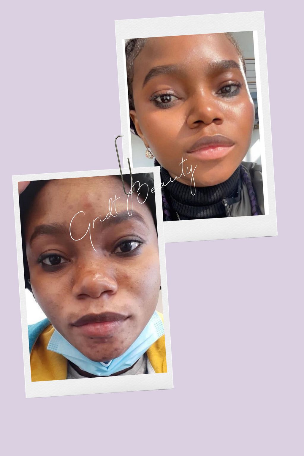 Lumi Bright, Anti-aging Day and Night Full Kit